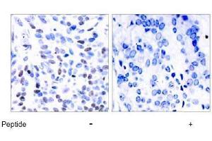 Image no. 1 for anti-Nuclear Factor of kappa Light Polypeptide Gene Enhancer in B-Cells 2 (NFKB2) (AA 864-868) antibody (ABIN197118) (NFKB2 Antikörper  (AA 864-868))