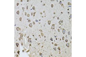 Immunohistochemistry of paraffin-embedded mouse brain using FGF2 antibody (ABIN1872685) at dilution of 1:100 (40x lens). (FGF2 Antikörper)