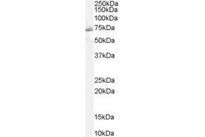 PTPN11 Antikörper  (C-Term)