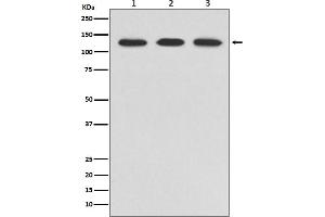 Western blot analysis of ABL2 expression in (1) HeLa cell lysate, (2) NIH/3T3 cell lysate, (3) PC-12 cell lysate.