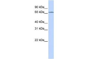 TRMT5 antibody used at 1 ug/ml to detect target protein. (TRMT5 Antikörper)