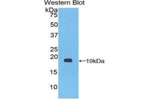 Western Blotting (WB) image for anti-Coagulation Factor VIII (F8) (AA 1887-2044) antibody (ABIN1858766)