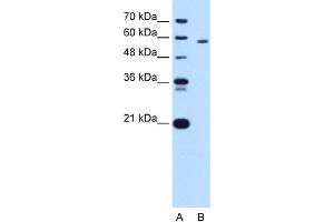 PKLR antibody - N-terminal region  validated by WB using HepG2 cell lysate at 1. (PKLR Antikörper  (N-Term))