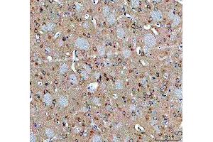 IHC analysis of ABI2 using anti-ABI2 antibody (ABIN7600125). (ABI2 Antikörper  (AA 151-400))