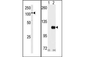 Image no. 2 for anti-Hexokinase 1 (HK1) (C-Term) antibody (ABIN360645) (Hexokinase 1 Antikörper  (C-Term))