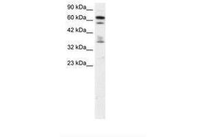 Image no. 1 for anti-Zinc Finger Protein 512 (ZNF512) (AA 205-254) antibody (ABIN6735835) (ZNF512 Antikörper  (AA 205-254))