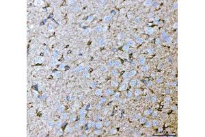 IHC analysis of Septin 2/SEPTIN2 using anti-Septin 2/SEPTIN2 antibody (ABIN7599275). (Septin 2 Antikörper  (AA 1-326))