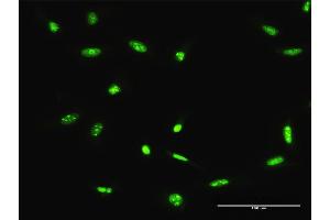 Immunofluorescence (IF) image for anti-Adenosine Deaminase, RNA-Specific (ADAR) (AA 1-1226) antibody (ABIN947535)