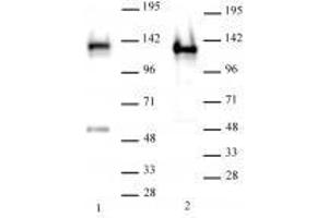SMARCA1 / SNF2L1 antibody (rAb) tested by Western blot. (Rekombinanter SMARCA1 Antikörper)
