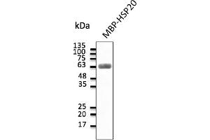 Western Blotting (WB) image for anti-Heat Shock Protein, alpha-Crystallin-Related, B6 (HSPB6) antibody (ABIN7273045) (HSPB6 Antikörper)