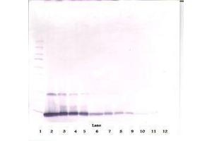 Image no. 1 for anti-Interleukin 4 (IL4) antibody (ABIN465482) (IL-4 Antikörper)