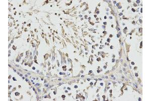 Immunohistochemistry (IHC) image for anti-Ribosomal Protein S3 (RPS3) antibody (ABIN1874658) (RPS3 Antikörper)