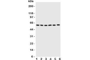 Western blot testing of SCYL antbody on Lane 1: U87;  2: HeLa;  3: 293T;  4: MCF-7;  5: COLO320;  6: HE1080 cell lysate (SCLY Antikörper  (C-Term))