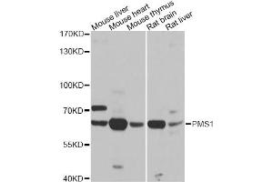 Western blot analysis of extracts of various cell lines, using PMS1 antibody. (PMS1 Antikörper)