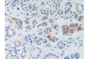 DAB staining on IHC-P; Samples: Human Stomach Tissue (BNP Antikörper  (AA 27-134))