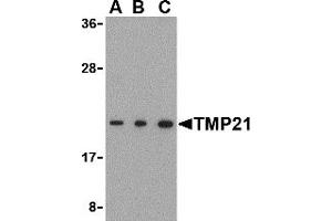Western Blotting (WB) image for anti-Transmembrane Emp24-Like Trafficking Protein 10 (TMED10) (C-Term) antibody (ABIN1030758) (TMED10 Antikörper  (C-Term))