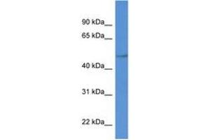 Image no. 1 for anti-Phospholipid Transfer Protein (PLTP) (C-Term) antibody (ABIN6749777) (PLTP Antikörper  (C-Term))