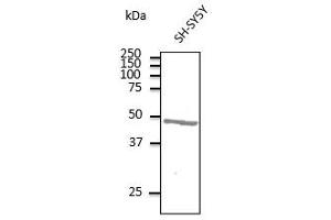 Anti-ATXN3 Ab at 1/500 dilution, lysates at 100 µg per Iane, rabbit polyclonal to goat lgG (HRP) at 1/10,000 dilution, (Ataxin 3 Antikörper  (AA 120-250))