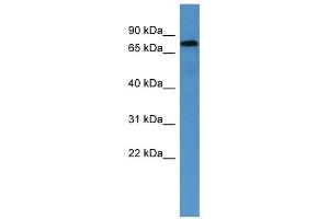ACO2 antibody used at 1 ug/ml to detect target protein. (ACO2 Antikörper  (Middle Region))