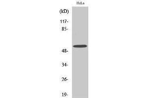 Western Blotting (WB) image for anti-Mixed Lineage Kinase Domain-Like (MLKL) (N-Term) antibody (ABIN3185589) (MLKL Antikörper  (N-Term))
