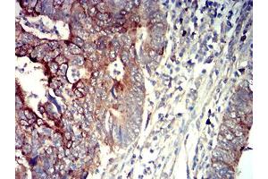 Immunohistochemistry (IHC) image for anti-Purinergic Receptor P2Y, G-Protein Coupled, 14 (P2RY14) antibody (ABIN5611336)