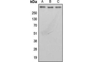 Western blot analysis of BRCA2 expression in MDAMB231 (A), MCF7 (B), rat lung (C) whole cell lysates.