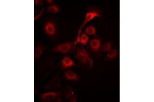 Immunofluorescent analysis of Prohibitin staining in Hela cells. (Prohibitin Antikörper)