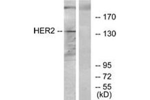 Western blot analysis of extracts from 293 cells, using HER2 Antibody. (ErbB2/Her2 Antikörper  (AA 641-690))