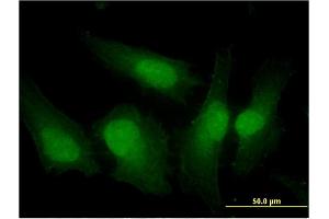 Immunofluorescence of monoclonal antibody to IRF3 on HeLa cell. (IRF3 Antikörper  (AA 1-452))