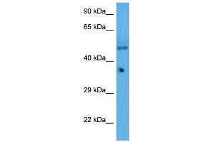 Host:  Rabbit  Target Name:  KLF5  Sample Tissue:  Mouse Pancreas  Antibody Dilution:  1ug/ml (KLF2 Antikörper  (Middle Region))