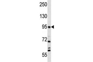 Western Blotting (WB) image for anti-Fibroblast Activation Protein, alpha (FAP) antibody (ABIN3030927)