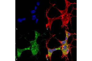 Immunocytochemistry/Immunofluorescence analysis using Mouse Anti-GFAP Monoclonal Antibody, Clone S206A-8 (ABIN1740957). (GFAP Antikörper  (AA 411-422) (FITC))