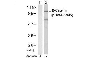 Western blot analysis of extracts from SW626 cells using b-Catenin(Phospho-Thr41/Ser45) Antibody(Lane 2) and the same antibody preincubated with blocking peptide(Lane1).