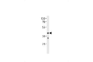 TR2 Antibody (N-term) (ABIN1881866 and ABIN2843381) western blot analysis in Jurkat cell line lysates (35 μg/lane).