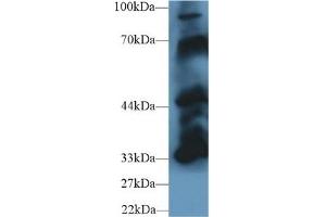 Detection of PTPN5 in Mouse Cerebrum lysate using Polyclonal Antibody to Protein Tyrosine Phosphatase, Non Receptor Type 5 (PTPN5) (PTPN5 Antikörper  (AA 270-533))