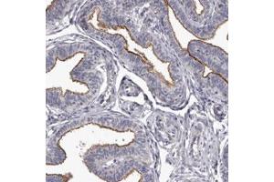 Immunohistochemical staining (Formalin-fixed paraffin-embedded sections) of human fallopian tube with GPRC5C polyclonal antibody  shows membrane positivity in glandular cells. (GPRC5C Antikörper)