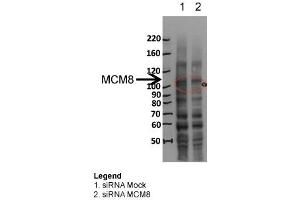 MCM8 WB Sample: siRNA Mock and siRNA MCM8 Dilution 1:1000 (MCM8 Antikörper  (N-Term))
