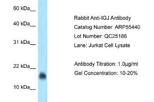 Western Blotting (WB) image for anti-Immunoglobulin J Polypeptide, Linker Protein For Immunoglobulin alpha and mu Polypeptides (IGJ) (N-Term) antibody (ABIN2786212) (IGJ Antikörper  (N-Term))