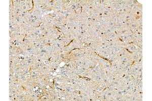ABIN7093250 and ABIN7097267 at 1/100 staining Rat brain tissue by IHC-P.