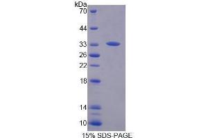 SDS-PAGE (SDS) image for N-Methylpurine-DNA Glycosylase (MPG) (AA 221-296), (AA 70-220) protein (His tag) (ABIN1878229) (MPG Protein (AA 70-220, AA 221-296) (His tag))