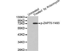 Western blot analysis of extracts from JK cells, using Phospho-ZAP70-Y493 antibody. (ZAP70 Antikörper  (pTyr493))