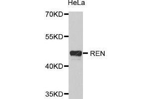 Western Blotting (WB) image for anti-Renin (REN) (AA 24-160) antibody (ABIN3022188)