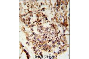 Formalin-fixed and paraffin-embedded human testis tissue reacted with ACR Antibody , which was peroxidase-conjugated to the secondary antibody, followed by DAB staining. (Achaete-scute complex protein T5 (AC) (AA 387-416), (C-Term) Antikörper)