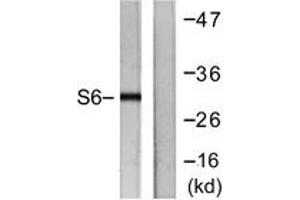 Western blot analysis of extracts from HeLa cells, treated with TNF-a 20ng/ml 2', using S6 Ribosomal Protein (Ab-240) Antibody. (RPS6 Antikörper  (AA 191-240))