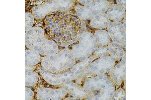 Immunohistochemistry of paraffin-embedded mouse kidney using NTF3 antibody (ABIN3017531, ABIN3017532, ABIN3017533 and ABIN6220139) at dilution of 1:100 (40x lens). (Neurotrophin 3 Antikörper)