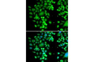 Immunofluorescence analysis of MCF-7 cells using PHYHD1 antibody. (PHYHD1 Antikörper)