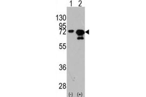 Western Blotting (WB) image for anti-Heat Shock 70kDa Protein 1A (HSPA1A) antibody (ABIN3003300) (HSP70 1A Antikörper)
