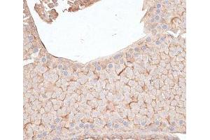 Immunohistochemistry of paraffin-embedded Mouse testis using KIAA1524 Polyclonal Antibody at dilution of 1:100 (40x lens).