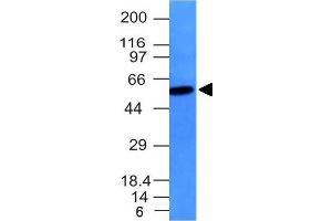 Western Blot Analysis Raji cell lysate Vimentin Mouse Monoclonal Antibody (VM452). (Vimentin Antikörper)