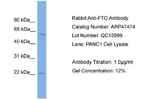 WB Suggested Anti-FTO  Antibody Titration: 0. (FTO Antikörper  (Middle Region))